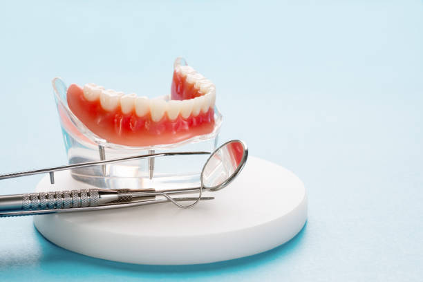 Dental Inlays and Onlays in Alturas, CA